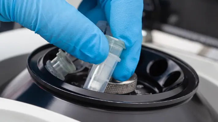 photo of a centrifuge - clicks through to HemoCue centrifuge products