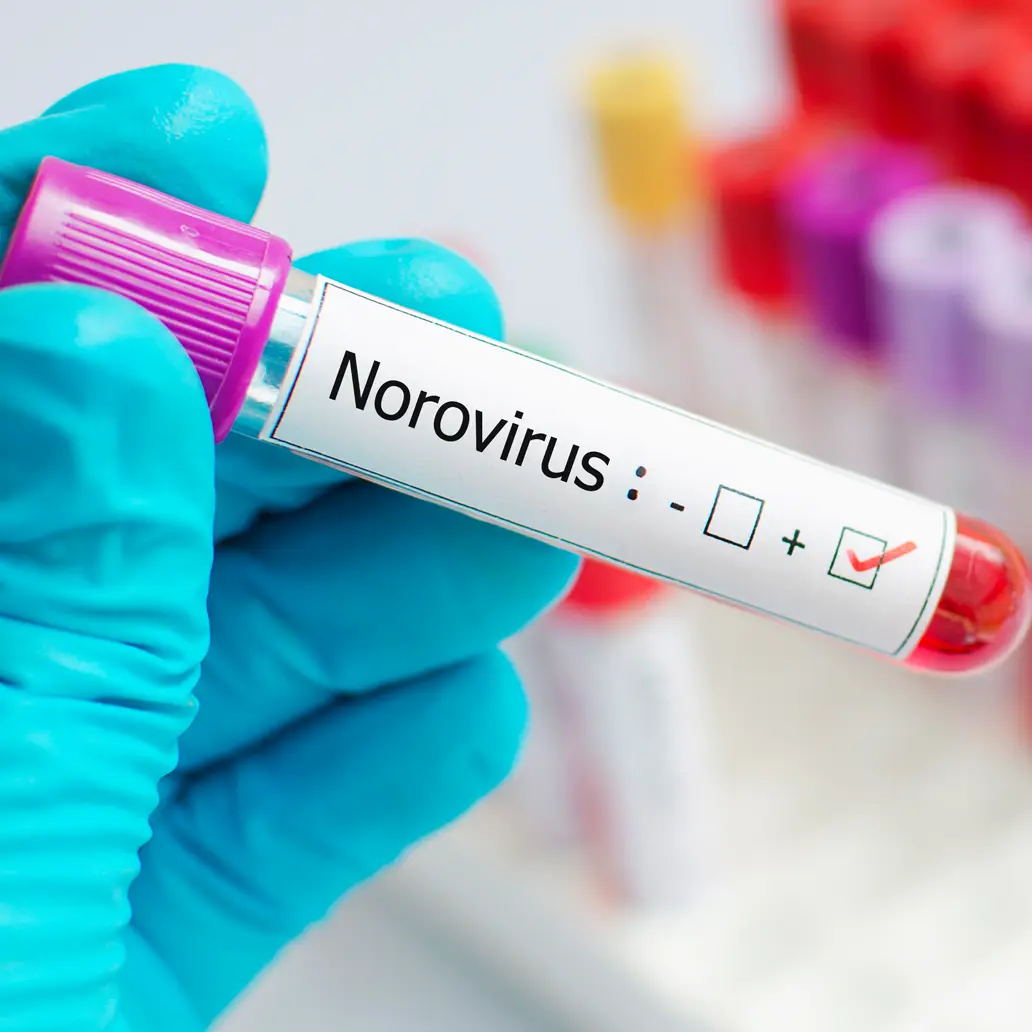 photo of a norovirus vaccine