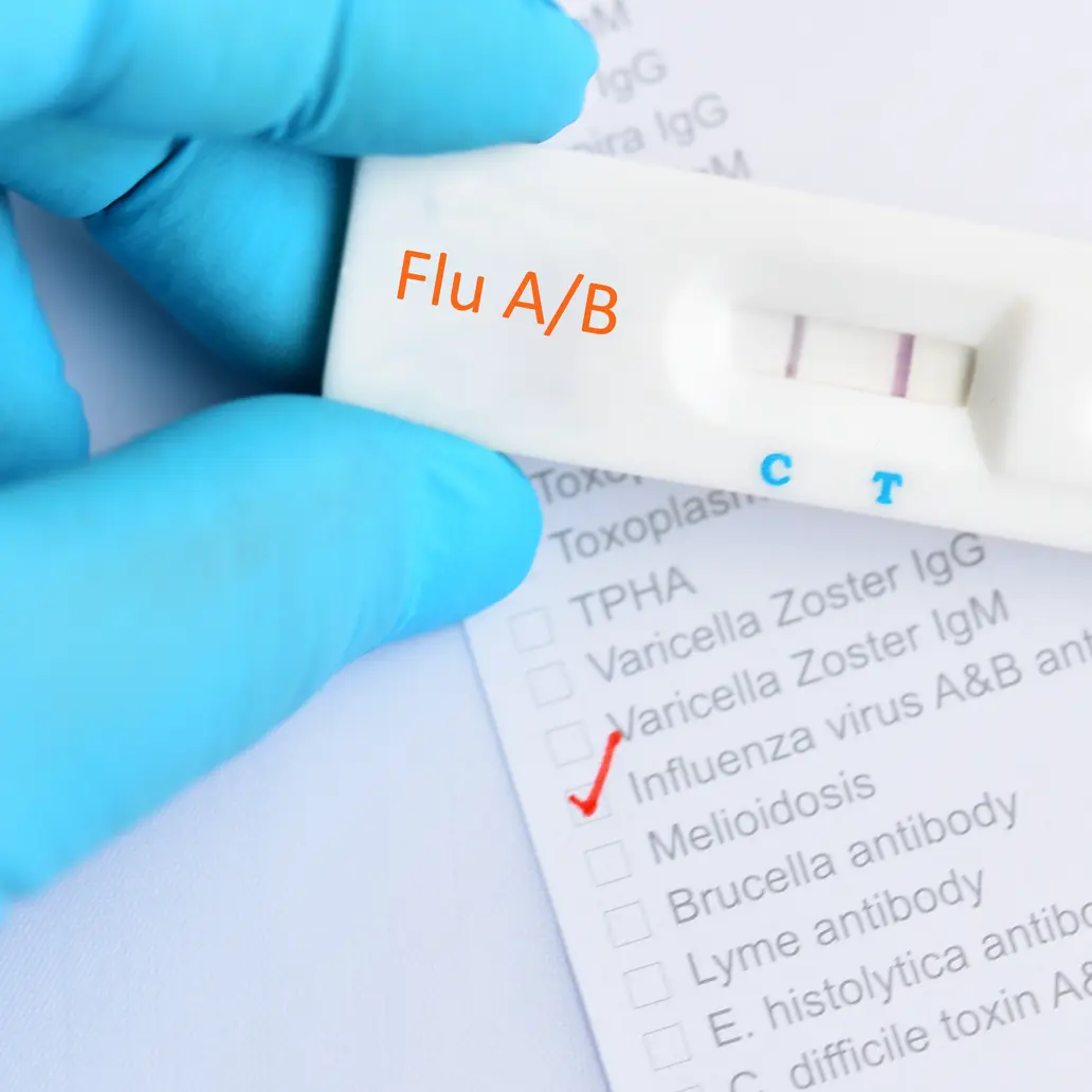 photo of a flu a/b test assay