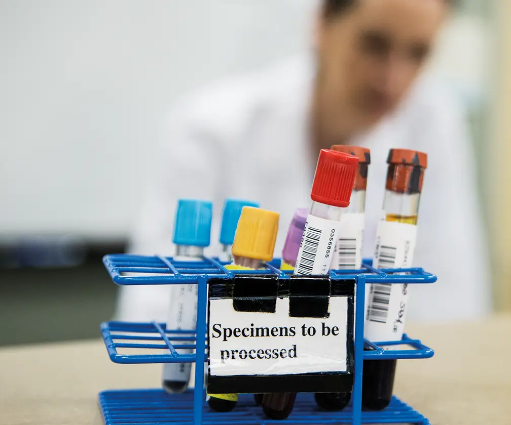 Image of lab specimens in test tubes to be processed