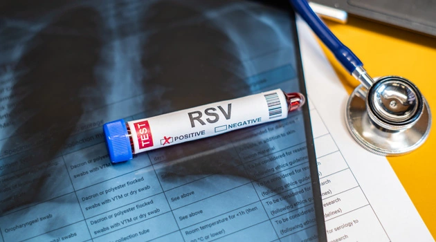 RSV FAQs: What providers need to know about the new RSV vaccines