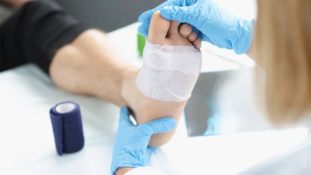 Treating a wound on the foot